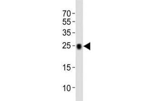 Western blot analysis of lysate from mouse kidney tissue lysate using CD9 antibody. (CD9 anticorps  (AA 115-145))