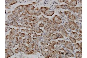 Immunostaining (ISt) image for anti-Importin 5 (IPO5) (AA 1-100) antibody (ABIN561620)