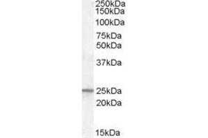 Western Blotting (WB) image for anti-Progesterone Receptor Membrane Component 1 (PGRMC1) antibody (ABIN5873921) (PGRMC1 anticorps)