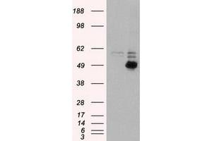 HEK293T cells were transfected with the pCMV6-ENTRY control (Left lane) or pCMV6-ENTRY CD4 (Right lane) cDNA for 48 hrs and lysed. (CD4 anticorps)