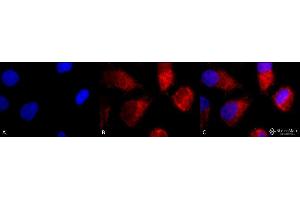Immunocytochemistry/Immunofluorescence analysis using Rabbit Anti-TNF-R1 Polyclonal Antibody . (TNFRSF1A anticorps  (AA 20-43) (PE))