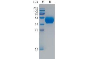 Human F(745-850)Protein, hFc Tag on SDS-PAGE under reducing condition. (FCRL5 Protein (Fc Tag))