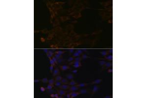 Immunofluorescence analysis of NIH-3T3 cells using HSP Rabbit mAb (ABIN1679173, ABIN3015940, ABIN3015941 and ABIN7101465) at dilution of 1:100 (40x lens). (HSPA14 anticorps)