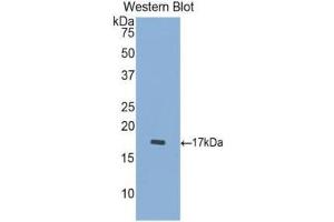Western Blotting (WB) image for anti-Cathepsin D (CTSD) (AA 23-161) antibody (ABIN1174453) (Cathepsin D anticorps  (AA 23-161))