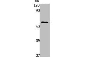 Western Blot analysis of K562 cells using CaMKIIδ Polyclonal Antibody (CAMK2D anticorps  (Internal Region))