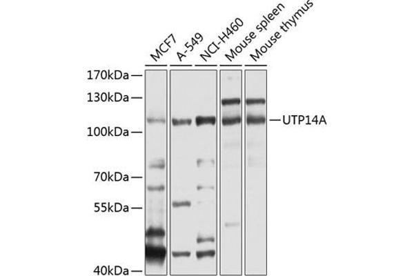 UTP14A anticorps  (AA 1-260)