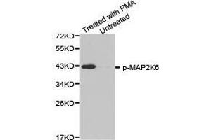 Western Blotting (WB) image for anti-Mitogen-Activated Protein Kinase Kinase 6 (MAP2K6) (pSer207) antibody (ABIN1870361) (MAP2K6 anticorps  (pSer207))