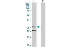 Western Blot analysis of IL6 expression in transfected 293T cell line by IL6 monoclonal antibody (M07), clone 1G8. (IL-6 anticorps  (AA 29-212))