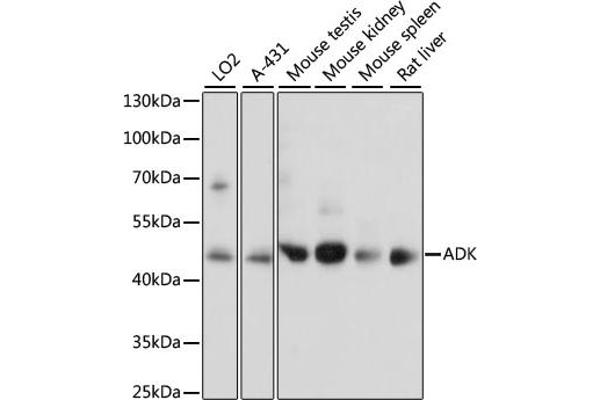 ADK anticorps  (AA 200-345)