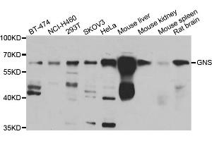 Western blot analysis of extracts of various cell lines, using GNS antibody (ABIN5975568) at 1/1000 dilution. (GNS anticorps)