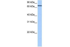 ADAD2 antibody used at 0. (ADAD2 anticorps  (C-Term))