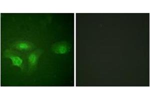 Immunofluorescence analysis of HepG2 cells, using HDAC6 (Phospho-Ser22) Antibody. (HDAC6 anticorps  (pSer22))