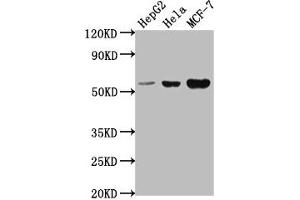 Western Blot Positive WB detected in: HepG2 whole cell lysate, Hela whole cell lysate, MCF-7 whole cell lysate All lanes: PRAMEF18 antibody at 1:2000 Secondary Goat polyclonal to rabbit IgG at 1/50000 dilution Predicted band size: 56 kDa Observed band size: 56 kDa (PRAMEF18 anticorps  (AA 1-257))