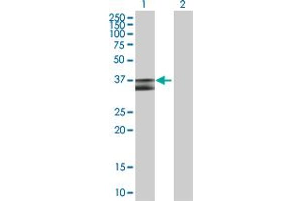 PDHB anticorps  (AA 1-359)