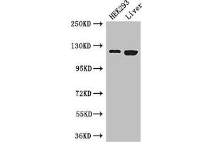 Western Blot Positive WB detected in: HEK293 whole cell lysate, Mouse liver tissue All lanes: PDGFRA antibody at 3 μg/mL Secondary Goat polyclonal to rabbit IgG at 1/50000 dilution Predicted band size: 123, 25, 83 kDa Observed band size: 123 kDa (PDGFRA anticorps  (AA 30-198))