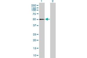 Western Blot analysis of CD177 expression in transfected 293T cell line by CD177 MaxPab polyclonal antibody. (CD177 anticorps  (AA 1-437))