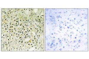 Immunohistochemistry (IHC) image for anti-Lectin, Galactoside-Binding, Soluble, 8 (LGALS8) (Internal Region) antibody (ABIN1850470) (LGALS8 anticorps  (Internal Region))