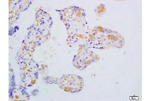 Formalin-fixed and paraffin embedded human placenta tissue labeled with Anti VEGF-B Polyclonal Antibody, Unconjugated (ABIN736313) at 1:200 followed by conjugation to the secondary antibody and DAB staining (VEGFB anticorps)