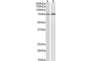 ABIN4902600 (0. (CYP2B6 anticorps)