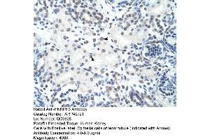 Rabbit Anti-HNRPH3 Antibody  Paraffin Embedded Tissue: Human Kidney Cellular Data: Epithelial cells of renal tubule Antibody Concentration: 4. (HNRNPH3 anticorps  (N-Term))