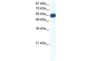 Western Blotting (WB) image for anti-Solute Carrier Family 18 (Vesicular Monoamine Transporter), Member 1 (SLC18A1) antibody (ABIN2461184) (SLC18A1 anticorps)