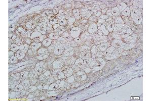 Immunohistochemistry (Paraffin-embedded Sections) (IHC (p)) image for anti-Follicle Stimulating Hormone Receptor (FSHR) (AA 201-300) antibody (ABIN729508)