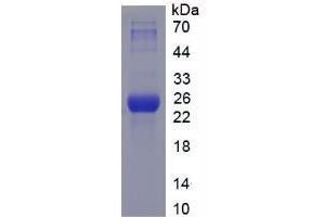 SDS-PAGE analysis of Mouse HSPA5 Protein. (GRP78 Protéine)