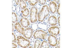 Immunohistochemistry of paraffin-embedded rat kidney using TST Rabbit pAb  at dilution of 1:200 (40x lens). (TST anticorps  (AA 1-297))