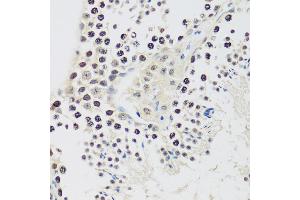 Immunohistochemistry of paraffin-embedded mouse testis using Cyclin E2 antibody (ABIN1679046, ABIN3018761, ABIN3018762 and ABIN6220571) at dilution of 1:100 (40x lens). (Cyclin E2 anticorps  (C-Term))