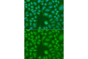 Immunofluorescence analysis of A549 cells using AES antibody. (AES anticorps)