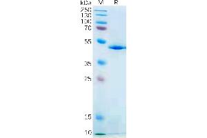 Human IL21 Protein, hFc Tag on SDS-PAGE under reducing condition. (IL-21 Protein (AA 30-162) (Fc Tag))