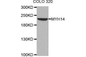 Western blot analysis of extracts of COLO320 cell line, using MYH14 antibody. (Myosin anticorps)