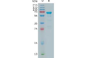 Human Protein, His Tag on SDS-PAGE under reducing condition. (MMP2 Protein (AA 30-660) (His tag))