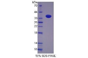 SDS-PAGE analysis of Rat NP Protein. (PNP Protéine)