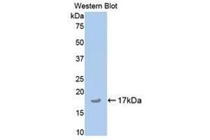 Western Blotting (WB) image for anti-Cartilage Oligomeric Matrix Protein (COMP) (AA 35-179) antibody (ABIN1174332) (COMP anticorps  (AA 35-179))