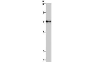 Western Blotting (WB) image for anti-Zinc Finger Protein 278 (ZNF278) antibody (ABIN2433541) (PATZ1 anticorps)