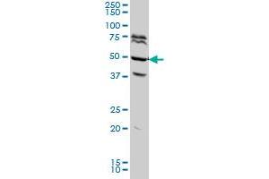 FOXA2 monoclonal antibody (M04A), clone 7G10 Western Blot analysis of FOXA2 expression in HeLa . (FOXA2 anticorps  (AA 363-457))