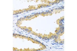 Immunohistochemistry of paraffin-embedded human prostate using KLK11 antibody. (Kallikrein 11 anticorps)