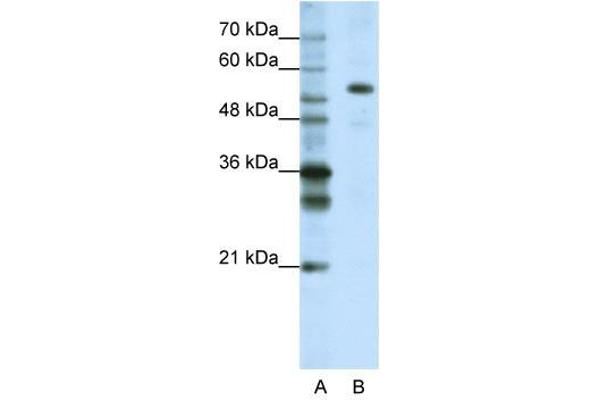 CPSF7 anticorps  (C-Term)