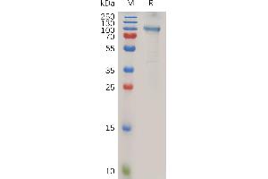 ADAM15 Protein (AA 18-696) (Fc Tag)