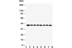 Western blot testing of PPID antibody and Lane 1:  rat brain;  2: rat pancreas;  3: rat liver;  4: Jurkat;  5: Raji;  6: CEM;  7: HL-60;  8: HT1080 cell lysate (PPID anticorps  (AA 351-370))