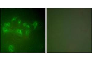 Immunofluorescence analysis of A549 cells, using MDM2 antibody (ABIN5976454). (MDM2 anticorps  (C-Term))