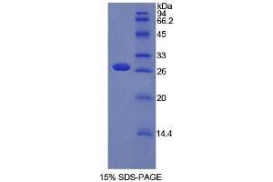 SDS-PAGE analysis of Mouse Patched 1 Protein. (Patched 1 Protein (PTCH1))