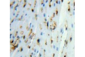 IHC-P analysis of Heart tissue, with DAB staining. (UGCGL2 anticorps  (AA 1221-1408))