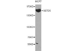 Western blot analysis of extracts of MCF-7 cells, using SETD5 antibody (ABIN5974406) at 1:300 dilution. (SETD5 anticorps)