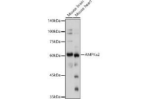 Western blot analysis of extracts of various cell lines, using AMPKα2 antibody (ABIN6129903, ABIN6146170, ABIN6146172 and ABIN6218273) at 1:1000 dilution. (PRKAA2 anticorps  (AA 343-552))