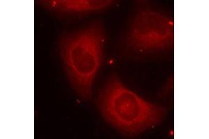 Immunofluorescence staining of methanol-fixed HeLa cells using Phospho-LIMK2-T505 antibody (ABIN2988124). (LIMK2 anticorps  (pThr505))