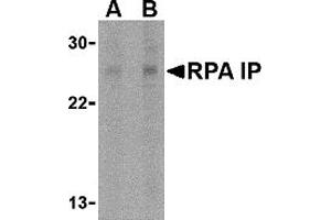 Western Blotting (WB) image for anti-RPA Interacting Protein (RPAIN) (C-Term) antibody (ABIN1030627) (RPAIN anticorps  (C-Term))