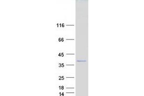 SCNM1 Protein (Myc-DYKDDDDK Tag)