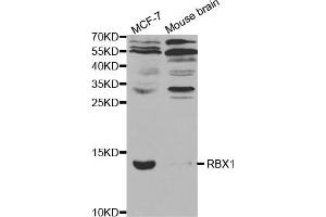 Western blot analysis of extracts of various cell lines, using RBX1 antibody (ABIN5970933) at 1/1000 dilution. (RBX1 anticorps)